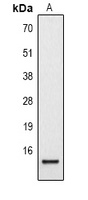 Histone H2B (Acetyl-K12) Antibody