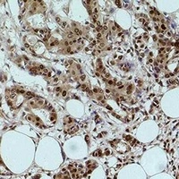 Histone H2B (Acetyl-K12) Antibody