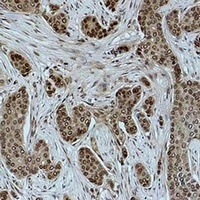 Anti-Histone H2B (Acetyl-K15) Antibody