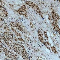 Histone H2B (AcK20) antibody