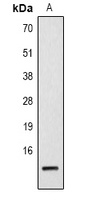 Histone H2B (Acetyl-K23) Rabbit Polyclonal Antibody