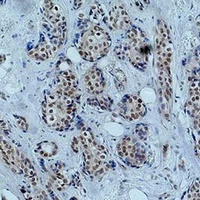 Histone H2B (Acetyl-K23) Rabbit Polyclonal Antibody