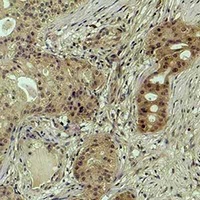 Histone H2B (DiMethyl-K43) Rabbit Polyclonal Antibody