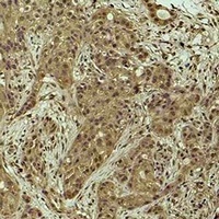 Histone H2B (DiMethyl-K5) Rabbit Polyclonal Antibody