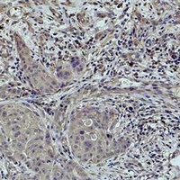 Histone H2B (MonoMethyl-K5) Rabbit Polyclonal Antibody