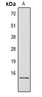 Histone H2B (Phospho-S32) Antibody