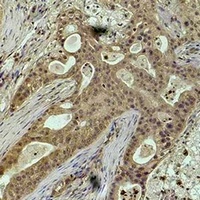 Histone H2B (Phospho-S32) Antibody