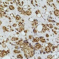 Histone H2B (TriMethyl-K43) Antibody