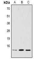 Histone H2B (TriMethyl-K5) Rabbit Polyclonal Antibody