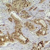 Histone H2B (TriMethyl-K5) Rabbit Polyclonal Antibody