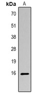 Histone H3 (Acetyl-K14) Antibody