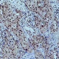 Histone H3 (AcK23) antibody