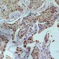 Anti-Histone H3 (Acetyl-K27) Antibody