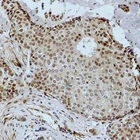 Histone H3 (Acetyl-K36) Antibody
