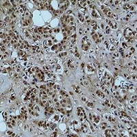 Histone H3 (AcK56) antibody