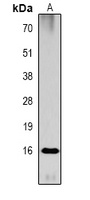 Histone H3 (Acetyl-K79) Antibody