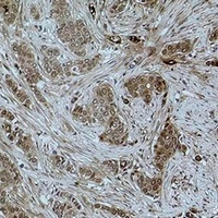Histone H3 (Acetyl-K79) Antibody