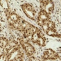 Histone H3 (AcK9) antibody