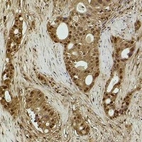 Histone H3 (DiMethyl-K14) Antibody