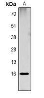 Histone H3 (DiMethyl-K18) Antibody