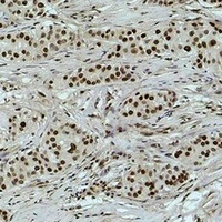 Histone H3 (DiMethyl-K18) Antibody
