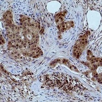 Anti-Histone H3 (DiMethyl-K27) Antibody