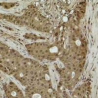 Anti-Histone H3 (TriMethyl-K14) Antibody