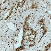 Histone H3 (TriMethyl-K18) Antibody