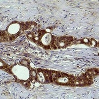 Anti-Histone H3 (TriMethyl-K27) Antibody