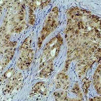 Anti-Histone H3 (TriMethyl-K4) Antibody