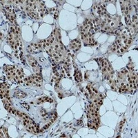 Anti-Histone H4 (Acetyl-K12) Antibody