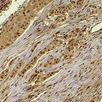 Anti-Histone H4 (Acetyl-K16) Antibody