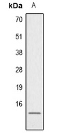 Histone H4 (Acetyl-K91) Rabbit Polyclonal Antibody