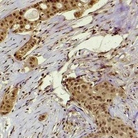 Histone H4 (Acetyl-K91) Rabbit Polyclonal Antibody