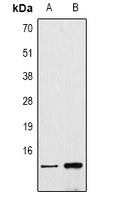 Histone H4 (DiMethyl-K20) Rabbit Polyclonal Antibody