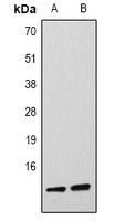 Histone H4 (DiMethyl-K59) Rabbit Polyclonal Antibody
