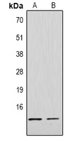 Histone H4 (DiMethyl-K79) Rabbit Polyclonal Antibody