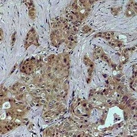 Histone H4 (DiMethyl-K79) Rabbit Polyclonal Antibody