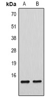 Histone H4 (MonoMethyl-K79) Rabbit Polyclonal Antibody