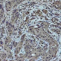 Histone H4 (MonoMethyl-K79) Rabbit Polyclonal Antibody