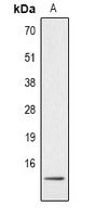 Histone H4 (MonoMethyl-R3) Rabbit Polyclonal Antibody