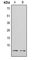 Histone H4 (TriMethyl-K20) Rabbit Polyclonal Antibody