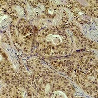Anti-Histone H4 (TriMethyl-K20) Antibody