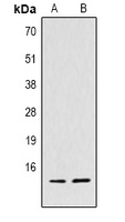 Histone H4 (TriMethyl-K59) Rabbit Polyclonal Antibody
