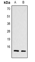 Histone H4 (TriMethyl-K79) Rabbit Polyclonal Antibody