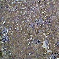 HSC70 Rabbit Polyclonal Antibody