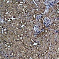 Anti-HSP27 Antibody