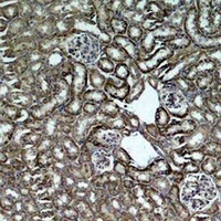 HSP60 antibody