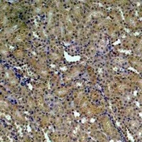 Anti-HSP90 alpha Antibody