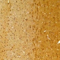 Anti-KCNK9 Antibody